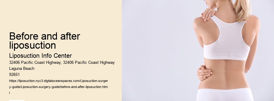 before and after liposuction